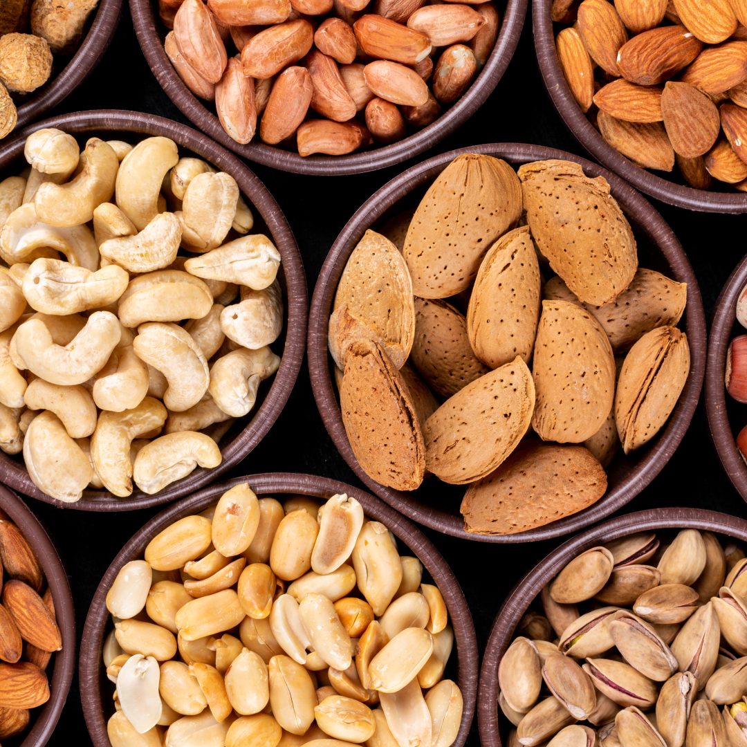 Horticulture Commodities Trading Platform - Dry Fruits